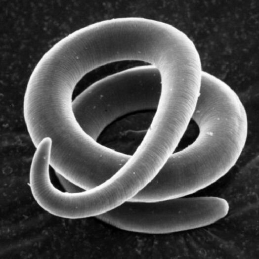 parazit trihinela pri ljudeh