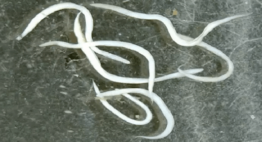 pinworms v človeškem telesu