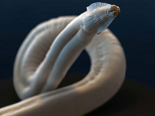 toksokar iz človeškega telesa