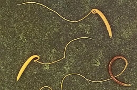 whipworm iz človeškega telesa