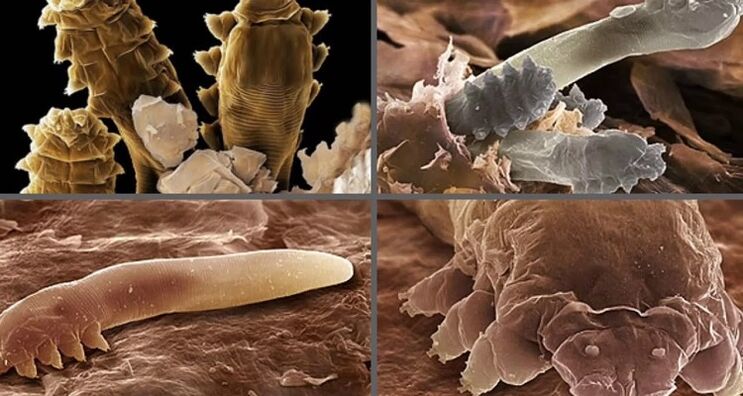 Vrste človeških kožnih parazitov