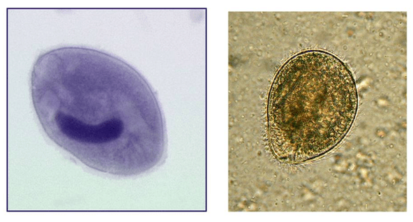 Balantidia ciliates, paraziti v debelem črevesu